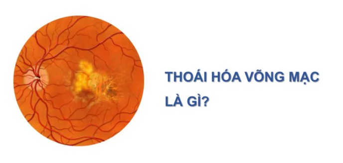 thoai-hoa-vong-mac-chu-bien-do-can-thi