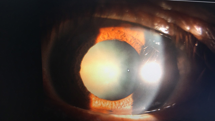 duc-thuy-tinh-the-va-nhung-dieu-can-biet