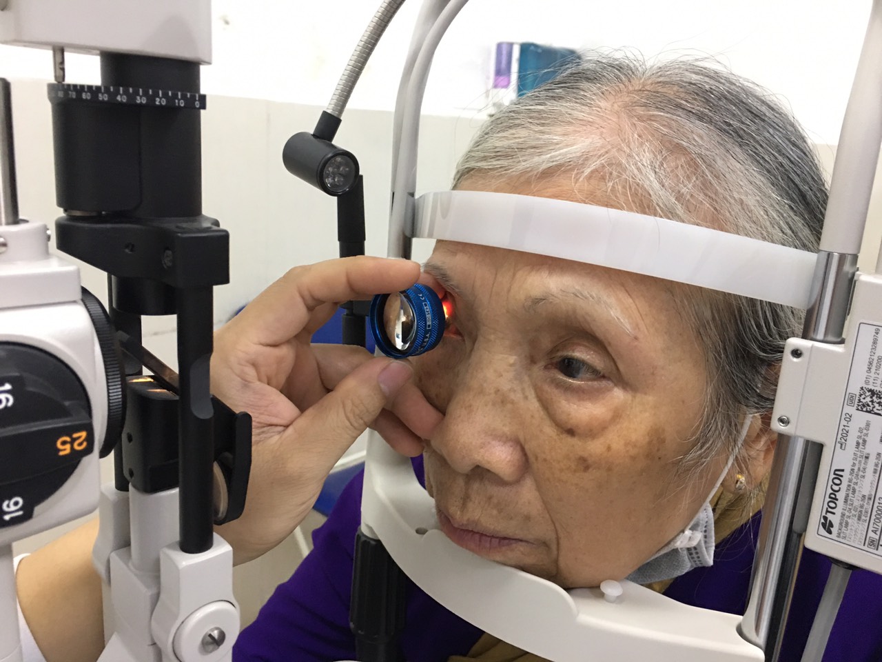 lao-thi-la-gi-nguyen-nhan-va-cach-dieu-tri