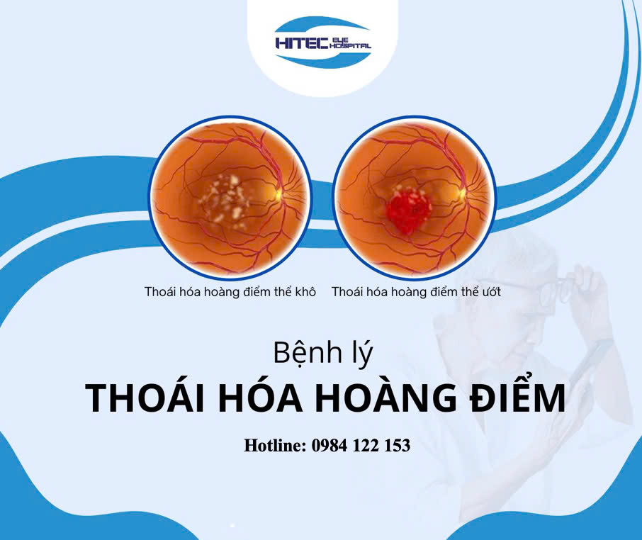 thoai-hoa-hoang-diem-hieu-dung-ve-benh-ly-gay-suy-giam-thi-luc-hang-dau-o-nguoi-cao-tuoi