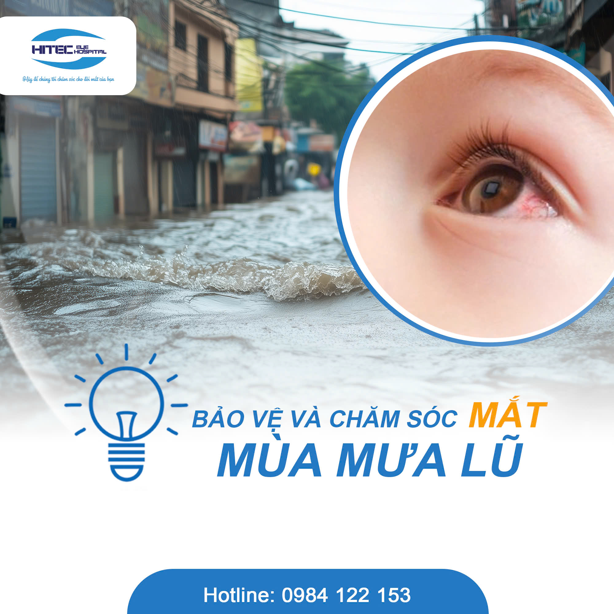 chuyen-gia-mat-hitec-tu-van-cham-soc-mat-sau-bao-so-3