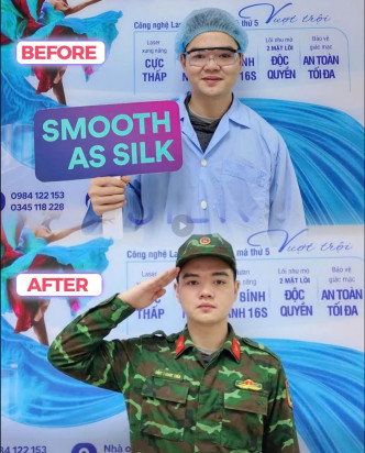 suyt-truot-ky-so-tuyen-vi-can-hon-5-do:-hanh-trinh-lay-lai-thi-luc-toi-uu-cua-mot-nam-sinh-2k7 