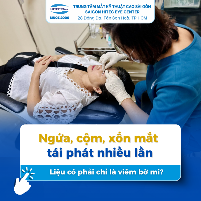 ngua-com-xon-mat-tai-phat-nhieu-lan lieu-co-phai-chi-la-viem-bo-mi
